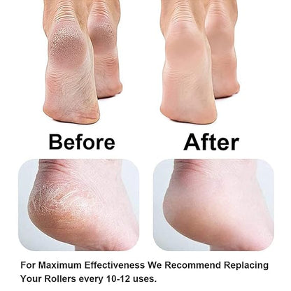 Callus Remover Rechargeable Pedicure Tool for Dead Skin